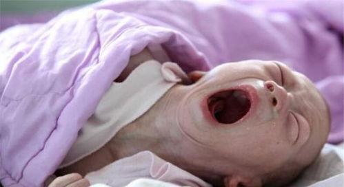 韩国产下畸形儿子视频,悲剧背后的医疗争议